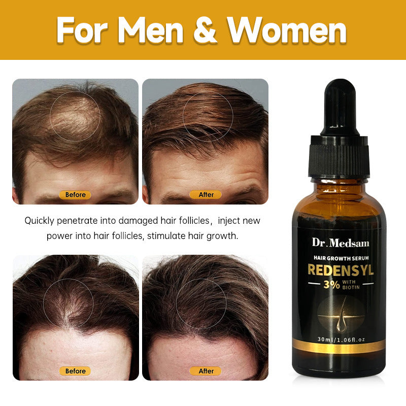 Biotin Rosmarin Haarwuchsserum – Verdickende & Stärkende Behandlung | 30ml