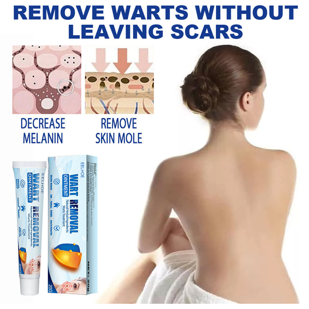 "EELHOE Wart Blemish Removal Cream Borneol Honeysuckle – AdriaPulse"