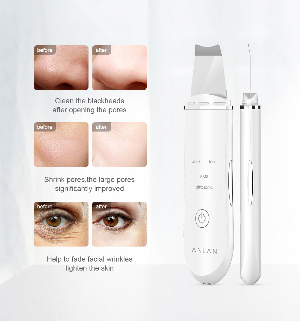 Ultraschall Skin Scrubber Tiefenreinigungsgerät Peeling Schaufel Gesichts-Porenreiniger Gesichtshaut Wäscher Lifting Maschine