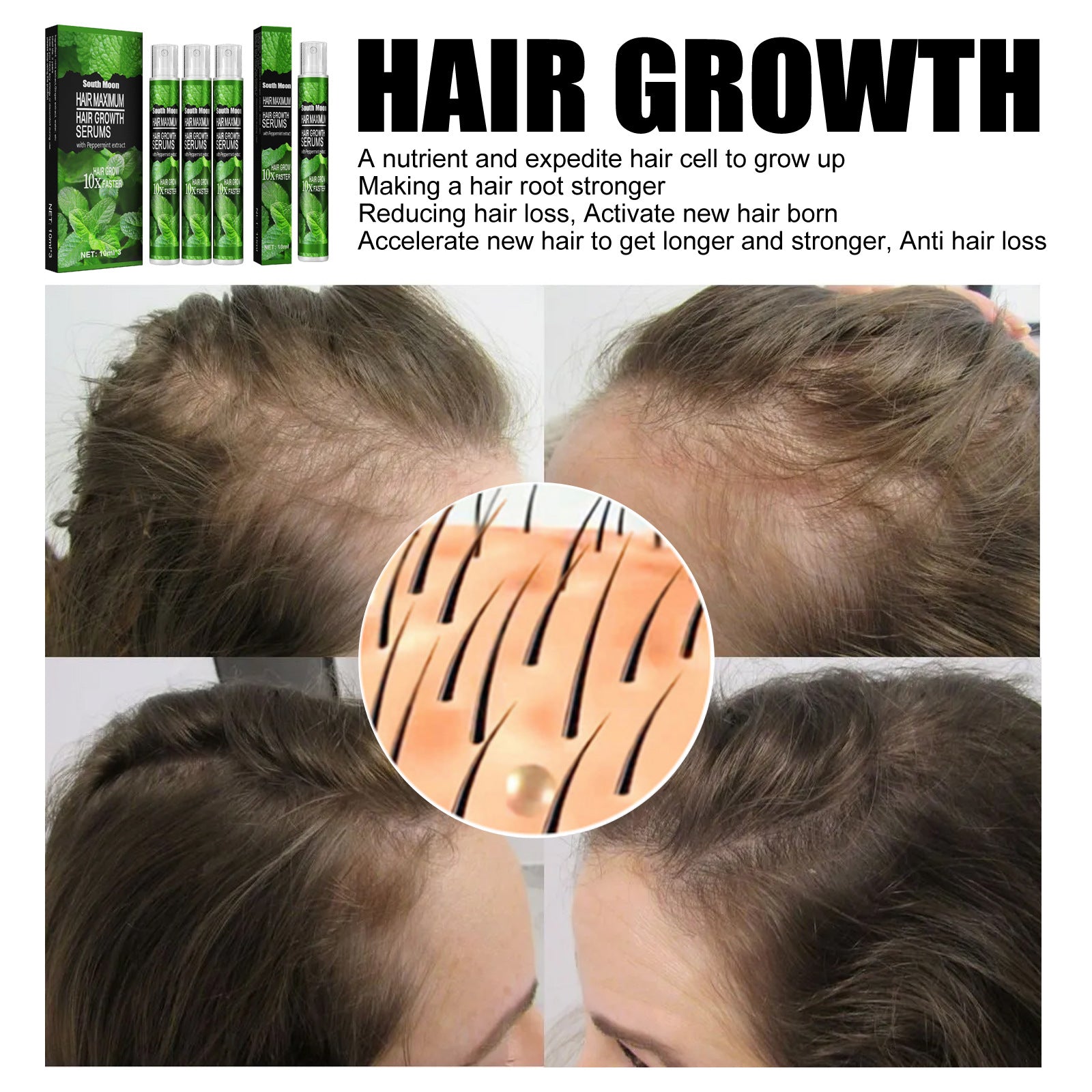 Mint Nourishing Hair Growth Spray – Moisturizing & Strengthening Scalp Treatment | 10ml