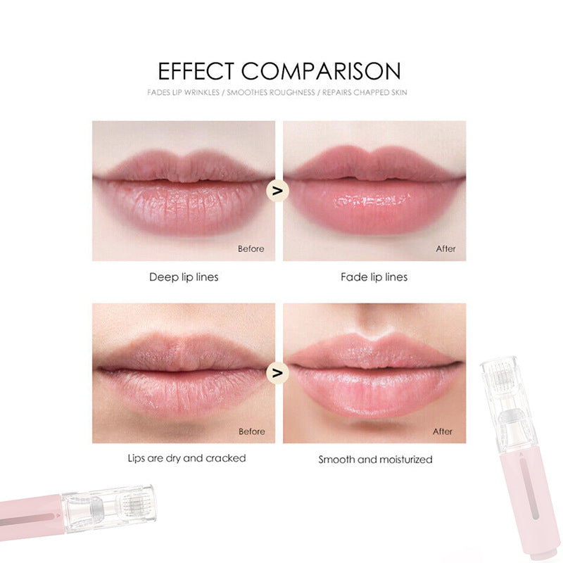 2-in-1 Microneedle Hydration Roller – Lip Care & Serum Applicator