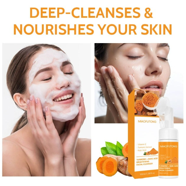 "Kojic Acid Turmeric Brightening Cleansing Mousse Dark Spot Correcting Face Wash 100ml – AdriaPulse"