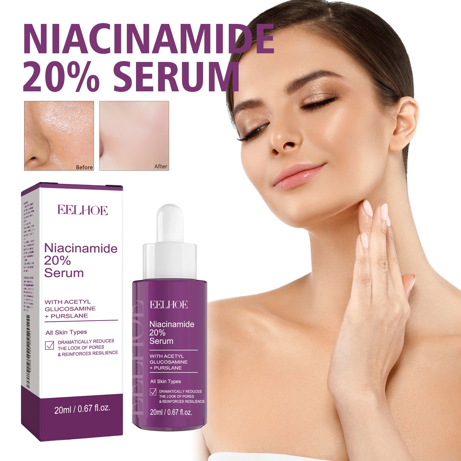 EELHOE Niacinamide Serum 20ml – Porenverfeinernde, aufhellende & faltenmindernde Hautpflege