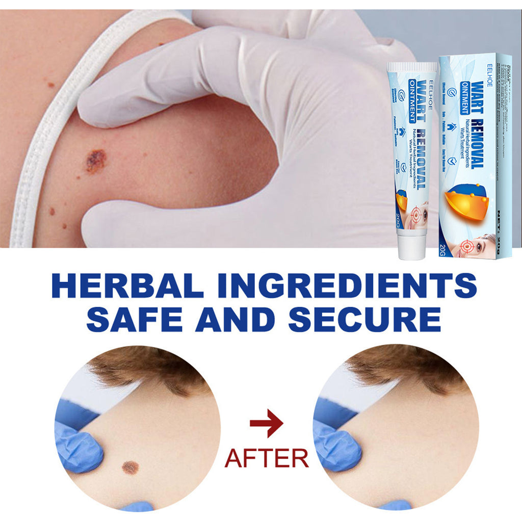 "EELHOE Wart Blemish Removal Cream Borneol Honeysuckle – AdriaPulse"